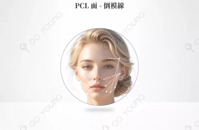 PCL 面 - 倒模線
