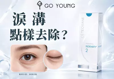 香港醫美：淚溝點樣去除？-Go Young