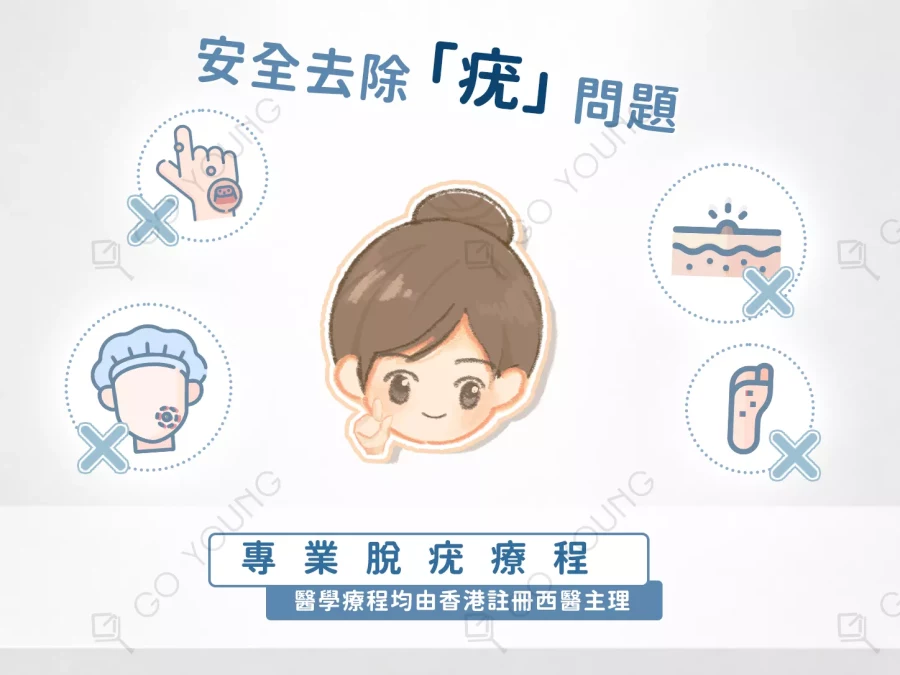 醫生主理 | 脫疣療程療程