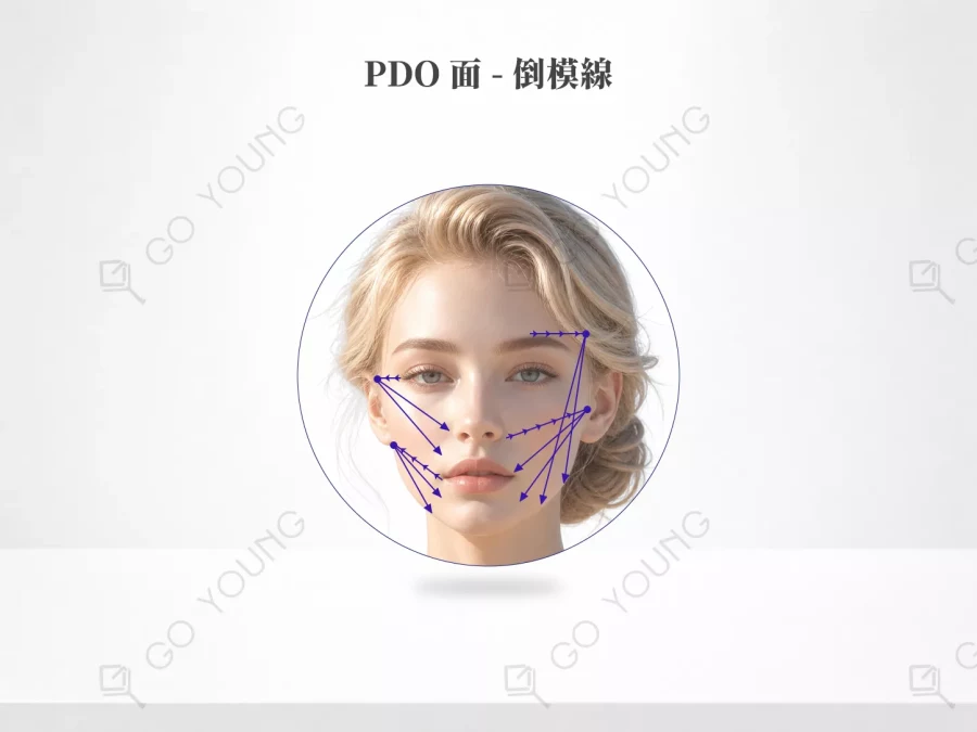 PDO 面 - 倒模線療程