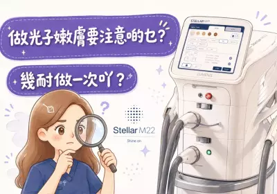 做光子嫩肤要注意啲乜？几耐做一次吖？ - GO YOUNG