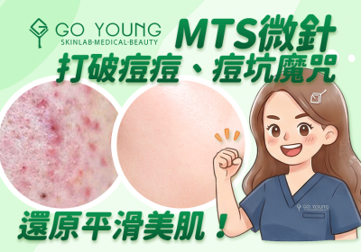mts 微針：打破痘痘、痘坑魔咒，還原平滑美肌！- Go Young