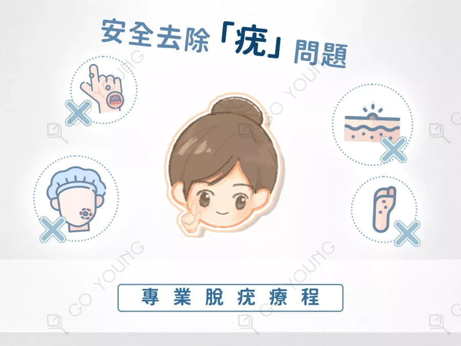 專業脫疣療程